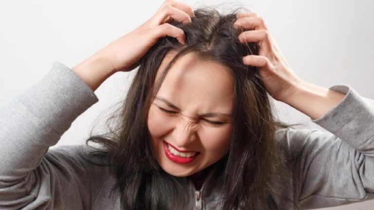 7 Natural Remedies for Dry Scalp Relief